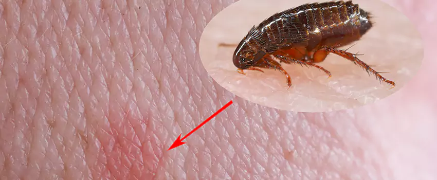 Flea Control for Humans Corona, CA